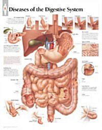 Diseases of Digestive System Chart: Wall Chart (Other)