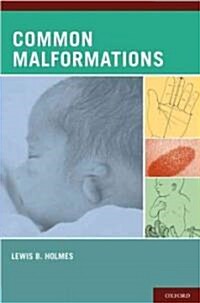 Common Malformations (Hardcover)