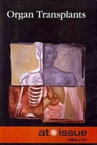 Organ Transplants (Paperback)