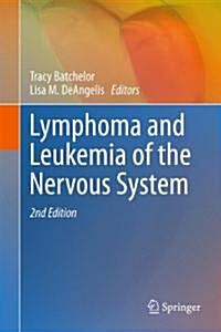 Lymphoma and Leukemia of the Nervous System (Hardcover, 2012)