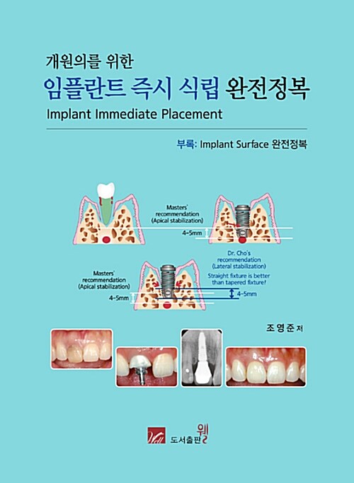 개원의를 위한 임플란트 즉시 식립 완전정복