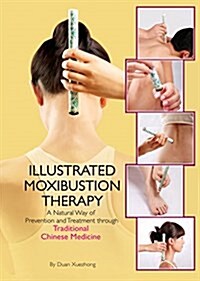 Illustrated Moxibustion Therapy: A Natural Way of Prevention and Treatment Through Traditional Chinese Medicine (Hardcover)