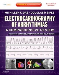 Electrocardiography of arrhythmias : a comprehensive review 1st ed