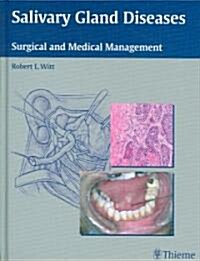 Salivary Gland Diseases: Surgical and Medical Management (Hardcover)