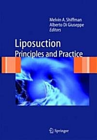 Liposuction: Principles and Practice (Hardcover)