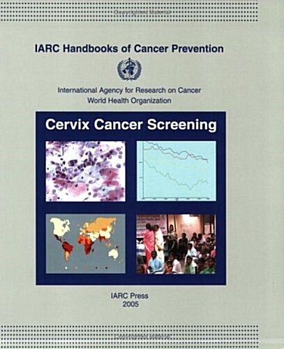 IARC Handbooks on Cancer Prevention (Paperback, 1st)