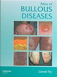 Atlas of Bullous Diseases (Hardcover)