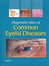 Diagnostic Atlas of Common Eyelid Diseases (Hardcover)