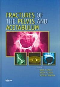 Fractures of the Pelvis And Acetabulum (Hardcover, 1st)