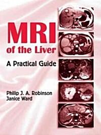 MRI of the Liver: A Practical Guide (Hardcover)