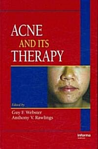 Acne and Its Therapy (Hardcover)