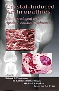 Crystal-Induced Arthropathies: Gout, Pseudogout and Apatite-Associated Syndromes (Hardcover)