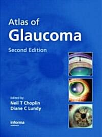 Atlas of Glaucoma (Hardcover, 2nd)