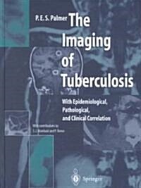 The Imaging of Tuberculosis: With Epidemiological, Pathological and Clinical Correlation (Hardcover)