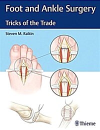 Foot and Ankle Surgery: Tricks of the Trade (Hardcover)