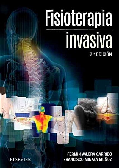 FISIOTERAPIA INVASIVA + ACCESO WEB(2  ED.) (Paperback)