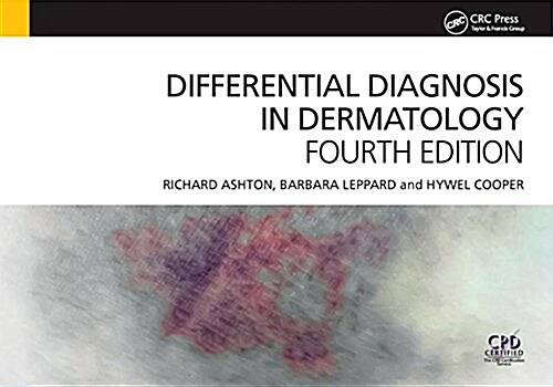 Differential Diagnosis in Dermatology (Hardcover, 4 New edition)