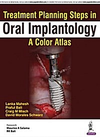 Treatment Planning Steps in Oral Implantology: A Color Atlas (Paperback)