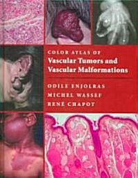 Color Atlas of Vascular Tumors and Vascular Malformations (Hardcover)