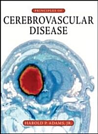 Principles of Cerebrovascular Disease (Hardcover, 1st)