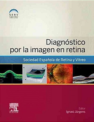 DIAGNOSTICO POR LA IMAGEN EN RETINA (Paperback)