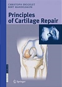 Principles of Cartilage Repair (Hardcover)
