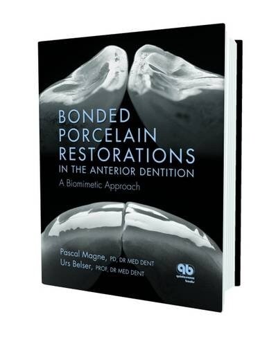Bonded Porcelain Restorations in the Anterior Dentition (Hardcover, SLP)
