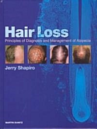 Alopecia : Principles of Diagnosis and Management of Hair Loss (Hardcover)