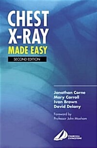 Chest X-Ray Made Easy (Paperback, 2nd, Subsequent)