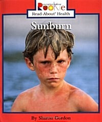 Sunburn (Paperback)