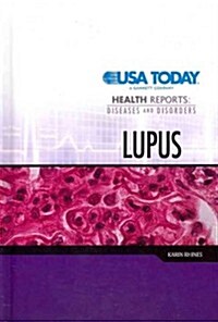 Lupus (Library Binding)