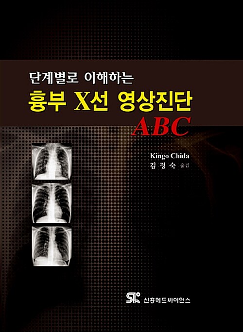 흉부 X선 영상진단 ABC