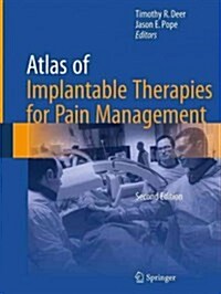Atlas of Implantable Therapies for Pain Management (Paperback, 2, Softcover Repri)