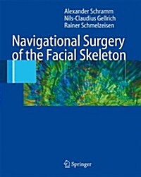 Navigational Surgery of the Facial Skeleton (Paperback, Softcover Repri)