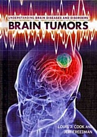 Brain Tumors (Library Binding)