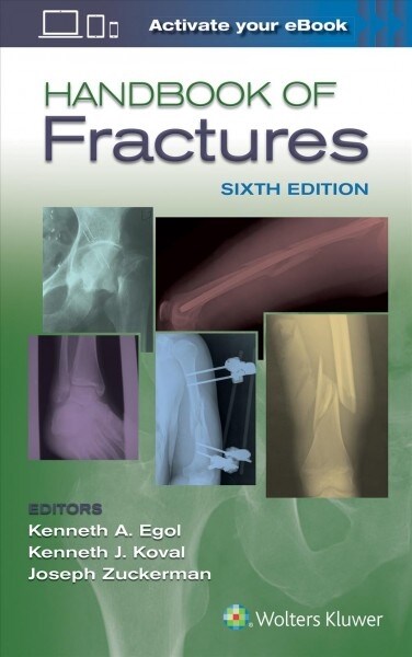 Handbook of Fractures (Paperback, 6)