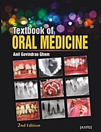 Textbook of Oral Medicine (Hardcover, 2nd)