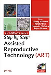 Step by Step: Assisted Reproductive Technology (Art) (Hardcover)