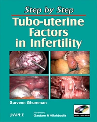Step by Step: Tubo-Uterine Factors in Infertility (Hardcover)