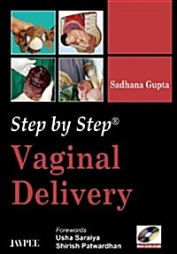 Step by Step: Vaginal Delivery (Paperback)