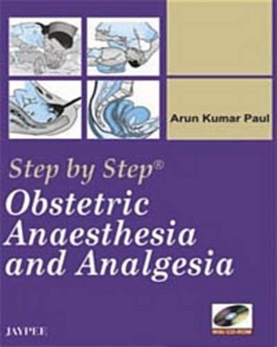 Step by Step: Obstetric Anaesthesia and Analgesia (Hardcover)