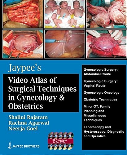 Jaypees Video Atlas of Surgical Techniques in Gynecology and Obstetrics (Paperback, DVD, 1st)