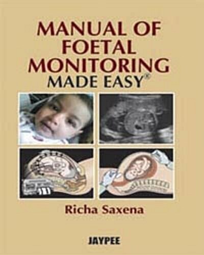 Manual of Fetal Monitoring Made Easy (Paperback, 1st)