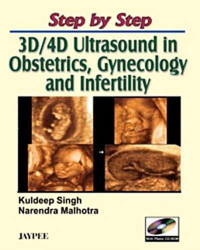 Step by Step: 3D and 4D Ultrasound in Obstetrics, Gynecology and Infertility (Hardcover)