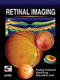 Retinal Imaging (Paperback)