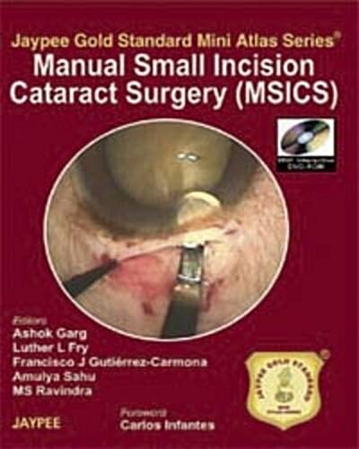 Manual of Small Incision Cataract Surgery (Paperback, DVD, 1st)
