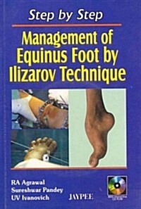 Step by Step: Management of Equinus Foot by Ilizarov Technique (Hardcover)