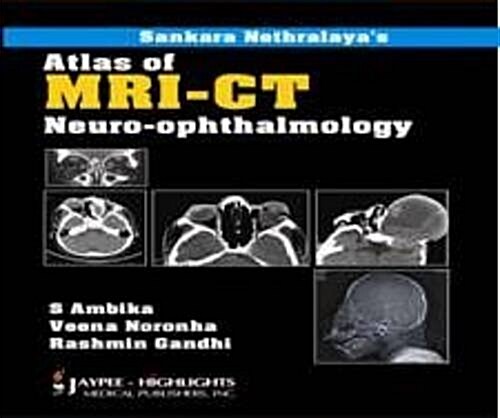 Sankara Nethralaya Atlas of Imaging in Ophthalmology (Hardcover, 1st)