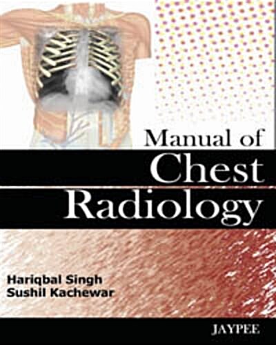 Manual of Chest Radiology (Hardcover, 1st)