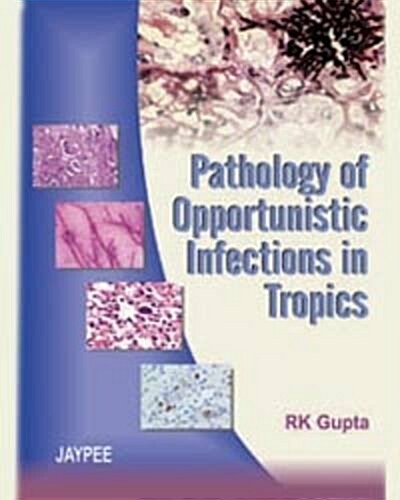 Pathology of Opportunistic Infections in Tropics (Hardcover)